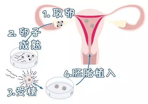 月经血块