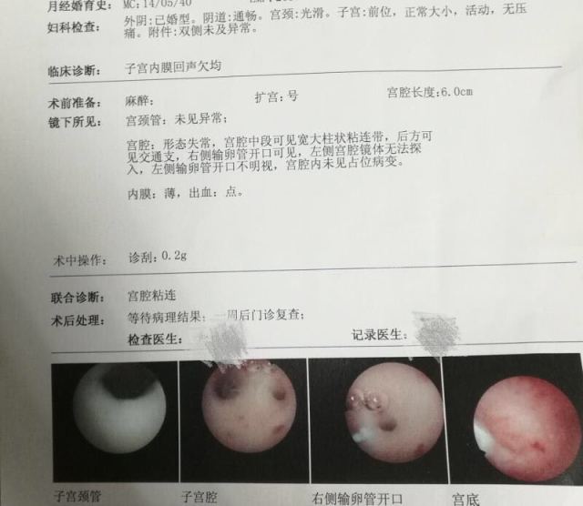 大卫验孕棒