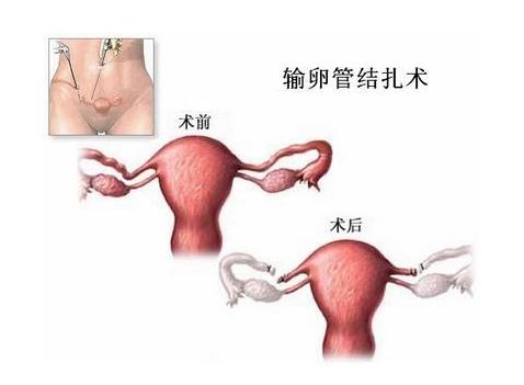 大卫早早孕试纸